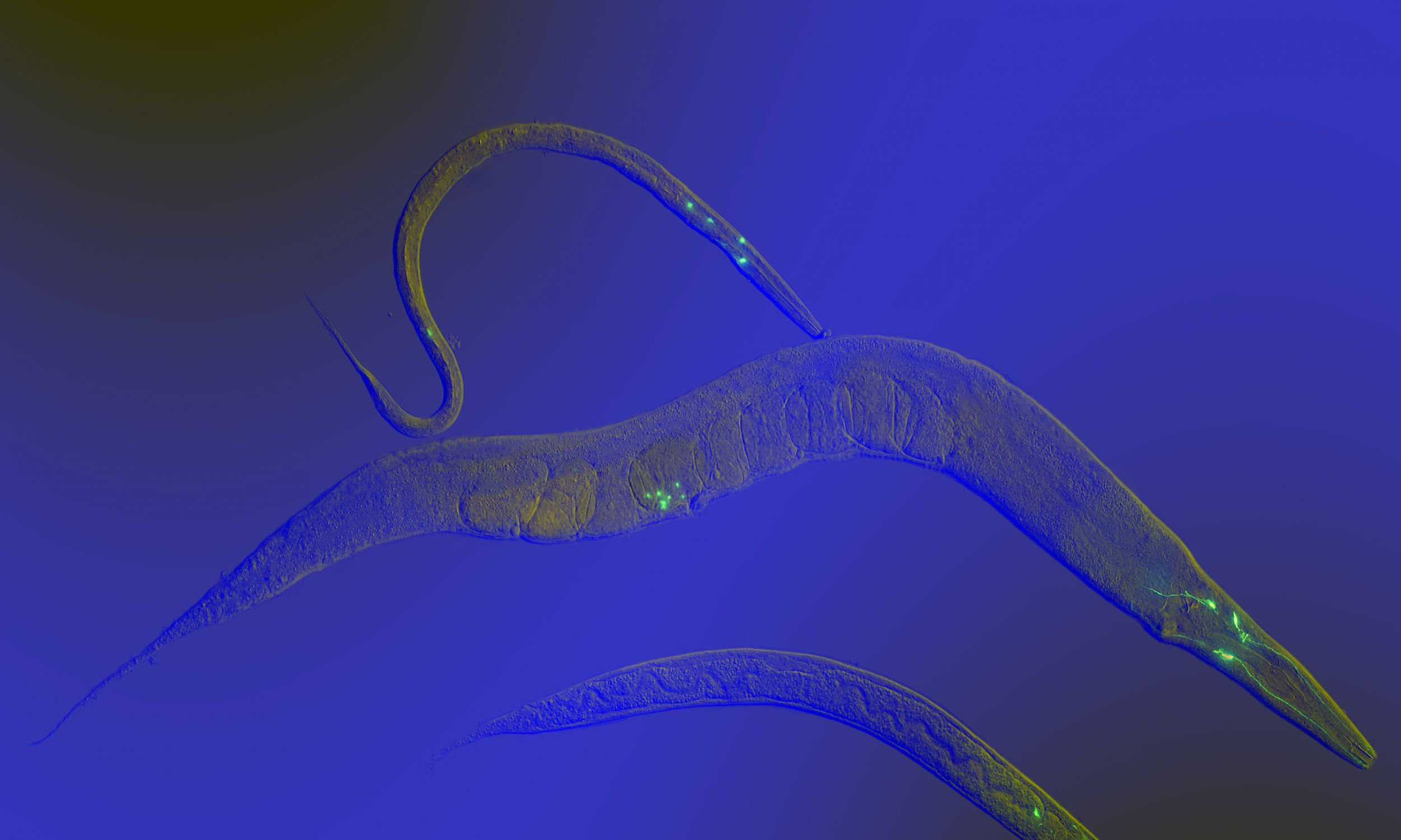 To zdjęcie jest zwycięzcą konkursu fotograficznego Science Photo 2007. Przedstawia C. elegans na różnych etapach rozwoju. Do trzech neuronów wprowadzono GFP (zielone białko fluorescencyjne) w celu wizualizacji rozwoju tych neuronów w robaku. Fotomikrografia, fluorescencja + kontrast interferencyjny różnicowy. Fot. Heiti Paves - Heiti Paves, CC BY-SA 4.0, https://commons.wikimedia.org/w/index.php?curid=82581247
