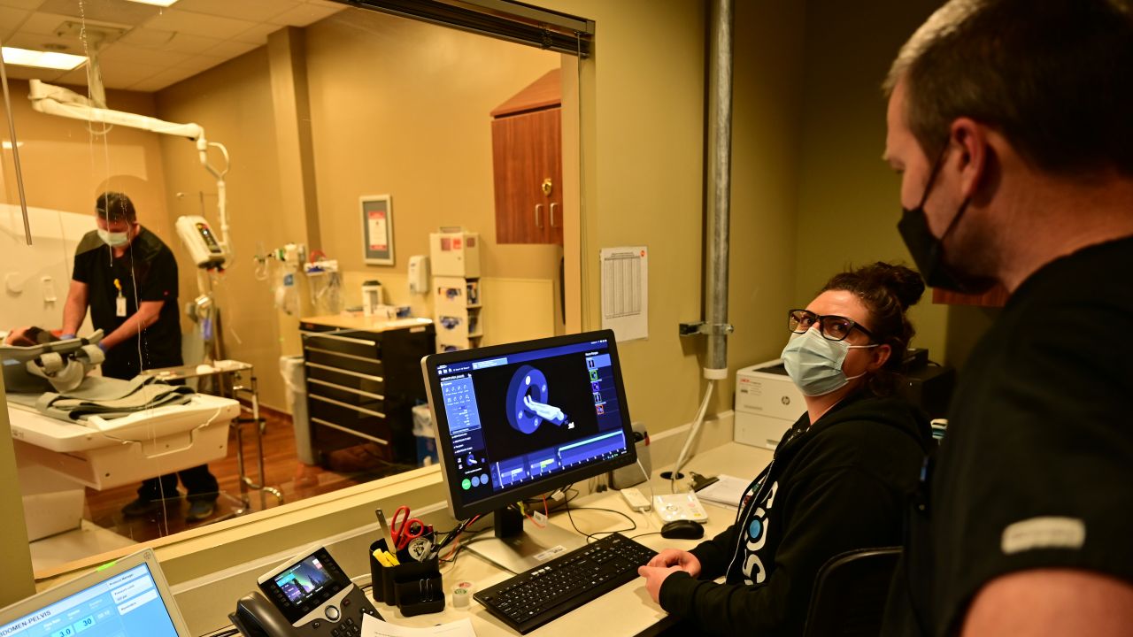 Rośnie liczba udarów mózgu. Coraz więcej przypadków u trzydziestolatków