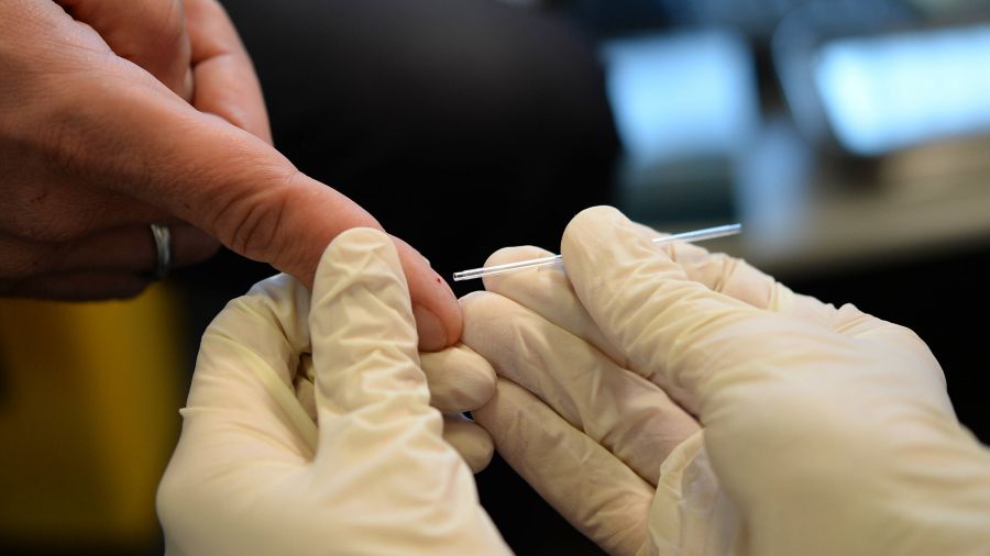 Bezpłatnie i bez skierowania. Test na HIV dostępne u lekarza pierwszego kontaktu
