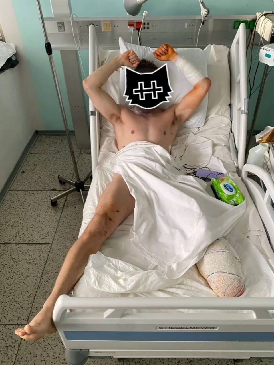 Беларускі добраахвотнік атрымаў раненне на аўдзееўскім кірунку. (Фота: Беларускі добраахвотніцкі корпус.)