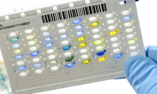 Karta Vitek Biomerieux - bakteriologiczna płytka identyfikacyjna umożliwiająca identyfikację bakterii w próbce krwi, moczu i ślinie oraz automatyczne wykonanie testu wrażliwości na środki przeciwdrobnoustrojowe. Fot. BSIP / UIG za pośrednictwem Getty Images