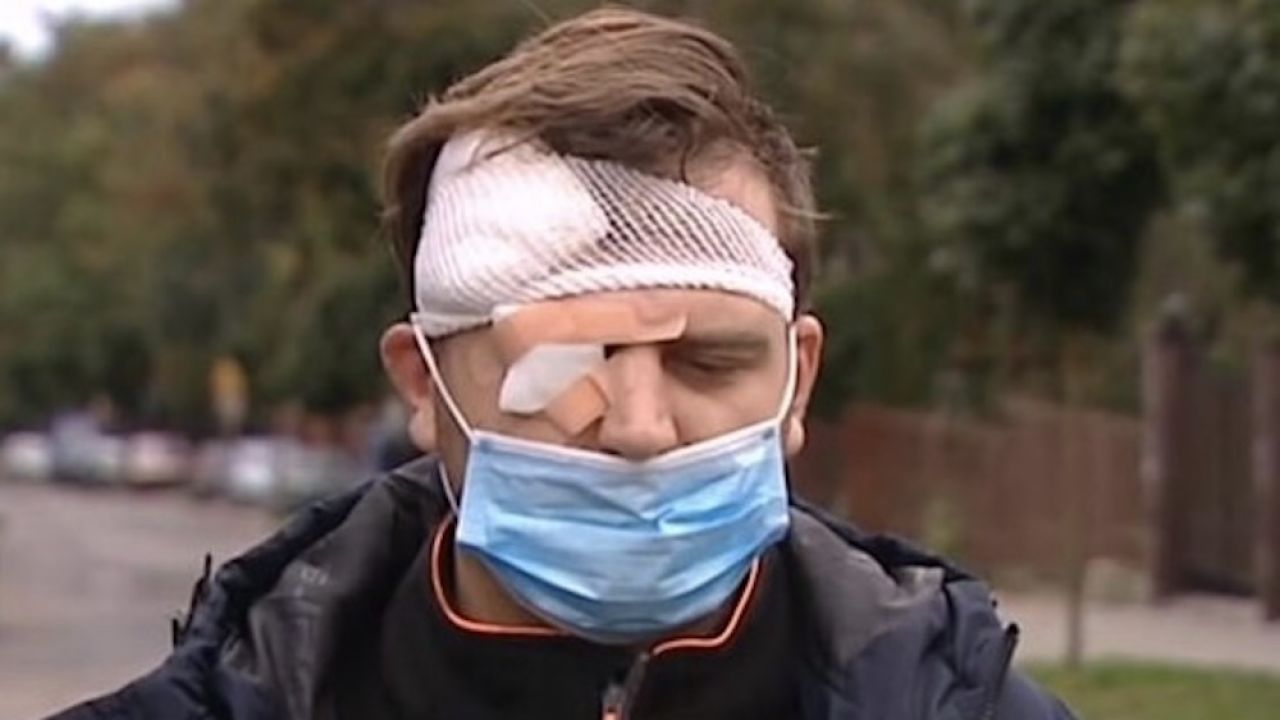 Sprawca pobicia, syn Ryszarda K., pozostaje na wolności (fot. TVP Info) Sprawca pobicia, syn Ryszarda K., pozostaje na wolności (fot. TVP Info)
